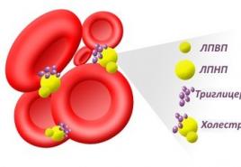Quantitative determination of low density lipoproteins (LDL) in blood serum Content of lipoproteins in blood serum